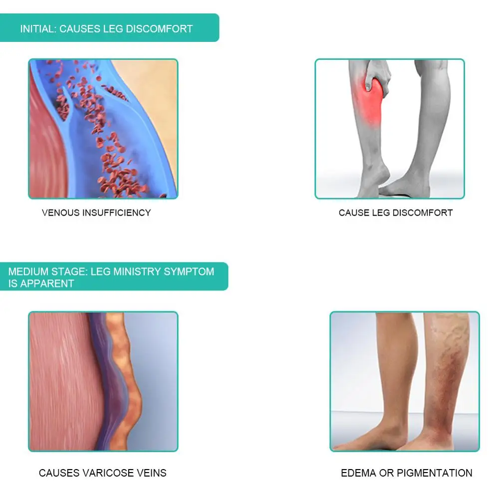 1Pair Medical Compression Sock - Compression Sleeve Calf 评论和价格