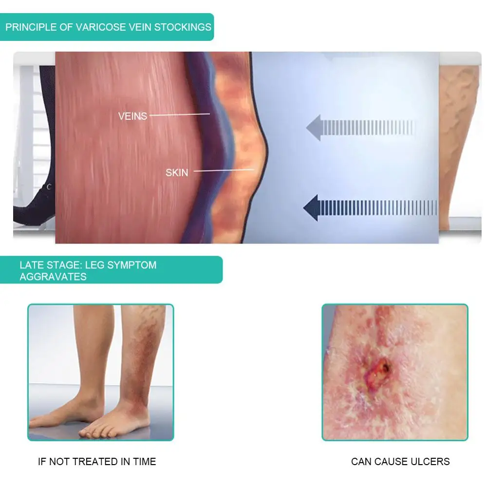 1Pair Medical Compression Sock - Compression Sleeve Calf 评论和价格